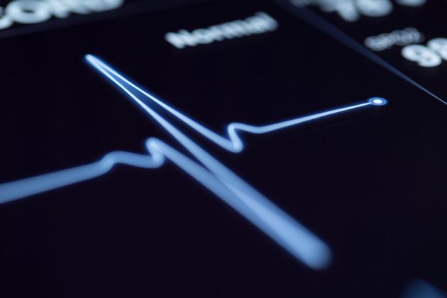 人工智能可以预测心脏病 比医生还准确