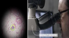 谷歌AR显微镜可快速检测癌细胞