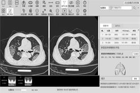 战“疫”中的“急先锋” 看AI在医疗影像场景中的落地