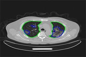 助力全球科技抗疫 腾讯医疗AI专利已达300余件
