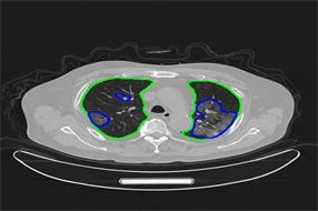 助力全球科技抗疫 腾讯医疗AI专利已达300余件