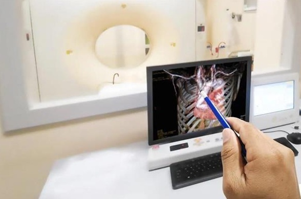 加快中风的诊断和治疗——AI来了!