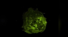 VR进军医疗     帮您更了解癌症