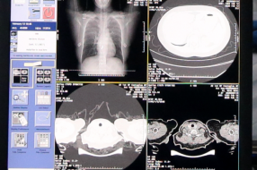 疑似诊断准确率96%只需20秒 这个AI什么来头?