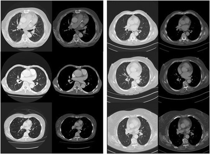 AI刚学会了一件挺残忍的事儿:预言死亡