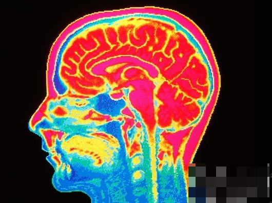通过人工智能与脑成像技术结合来预测自杀倾向方法