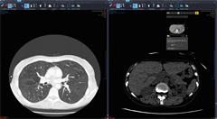 巨头布局医疗云计算，2017年十大新战场