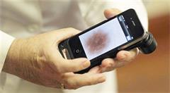 人工智能诊断皮肤癌 打败17国58名专业医生