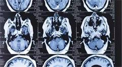 人工智能在医疗保健领域投资最多;全球高校人工智能学术联盟成立